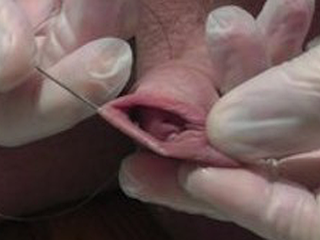 Brutal needles cock glans connected e- stim