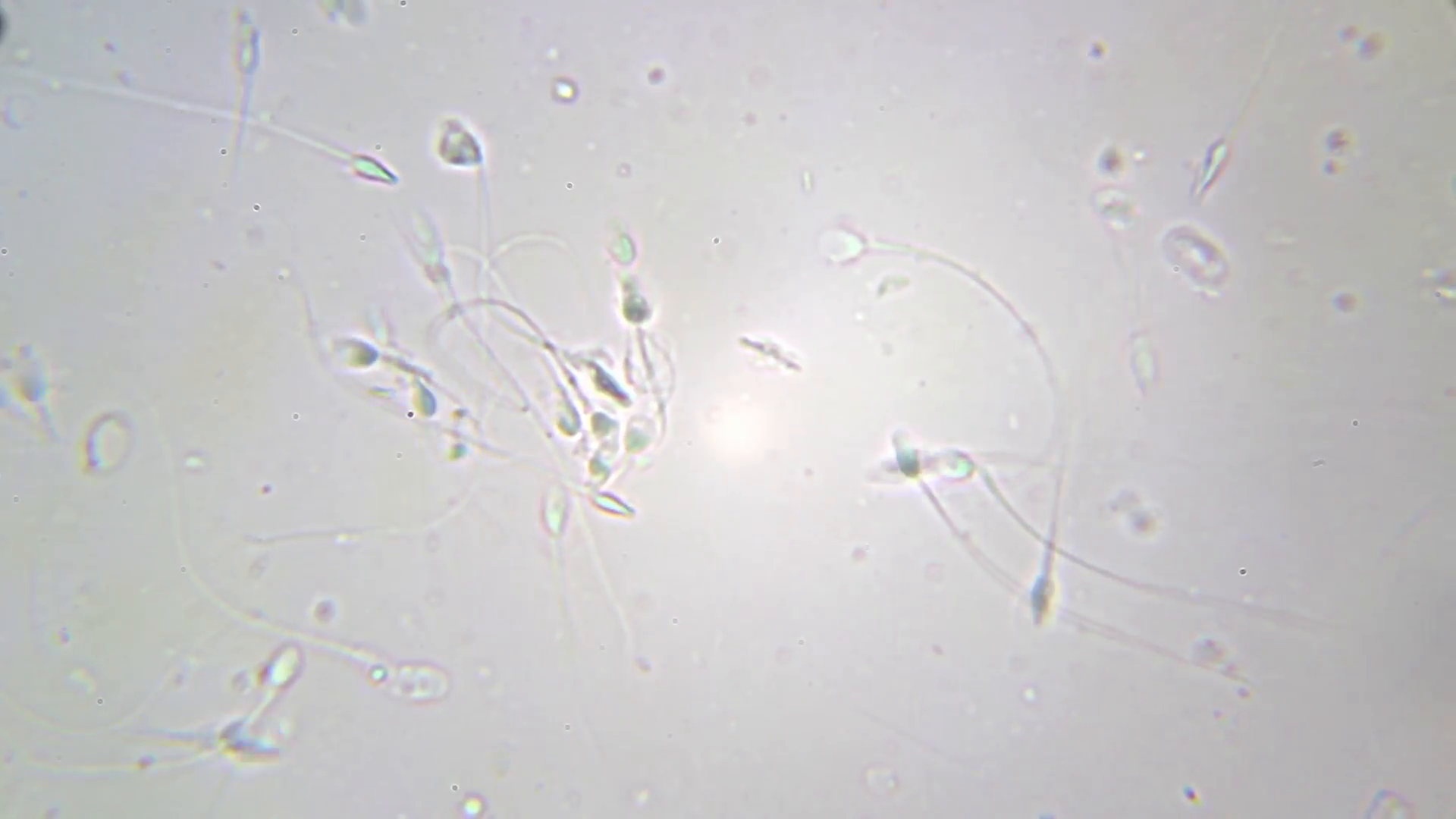 best of Microscope sperm