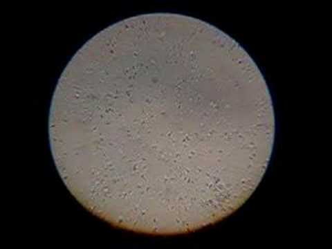 Sperm microscope
