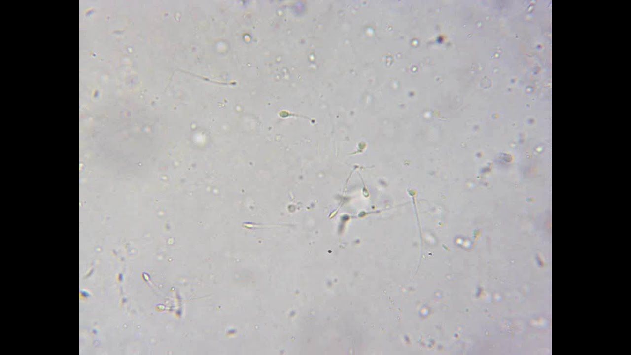Sperm microscope
